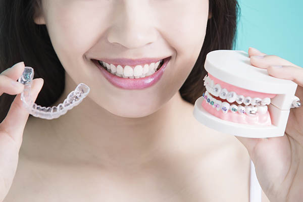 Time to Improve Your Smile with Clear Aligners